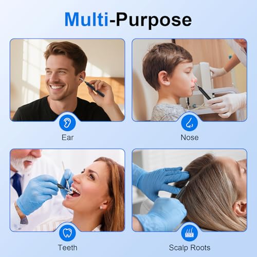 Image of Oxbird(200-300W-PX) HD Wireless Otoscope with Light Ear Wax Camera, Ear Wax Remover Removal Cleaner Cleaning Kit, Suitable for Apple /Android, Dad and Madam Artifact,Perpetual Commitment