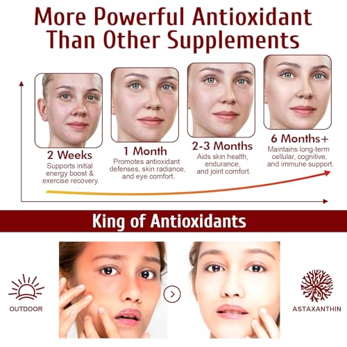 Astaxanthin 12mg, 120 Weichkapseln (4 Monatsvorrat) | aus Haematococcus Pluvialis Mikroalgen | Fördert Augen, Haut & Gelenkgesundheit | GMO-frei & Glutenfrei