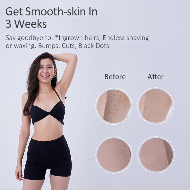 TZWM IPL Haarentfernungsgerät 3-in-1 (HR/DPL/MG), 21J Salon-Level bis 6J/cm², 5 Stufen, Ultra-Schnellblitz, Dauerhafte Haarentfernung für Gesicht & Körper Damen & Herren