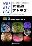新しい診断基準・分類に基づいた NBI/BLI/LCI内視鏡アトラス