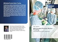 MRI-Guided Prostate Motion Tracking 3639512731 Book Cover