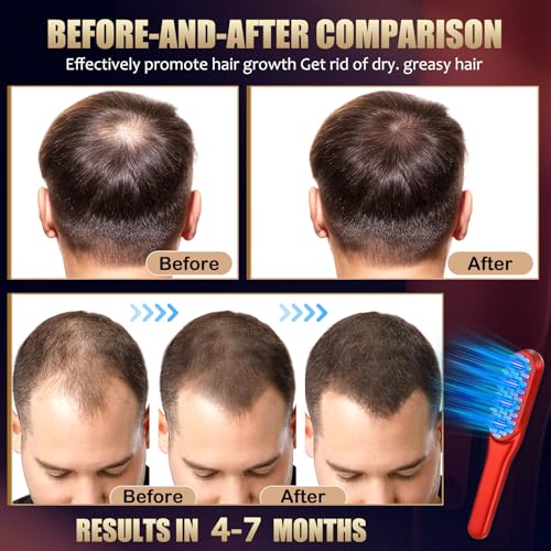 Laser Hair Growth Comb,Red Light Hair Growth Treatment for Men & Women(Red 1pcs )