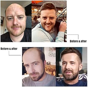 lordhair ultra thin skin men s toupee hair replacement