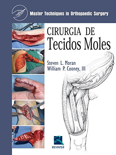 Cirurgia de Tecidos Moles: Master Techniques In Orthopedic Surgery