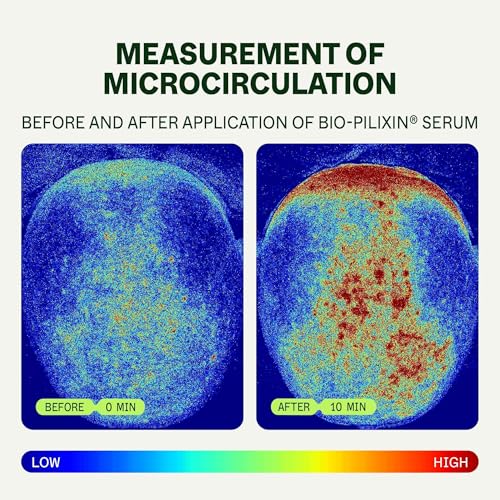 Scandinavian Biolabs Bio-Pilixin® Hairline Booster – Formula Attivante Con Applicatore Massaggiante, Per La Longevità Del Bordo Frontale, Vegano, 15 Ml - 7