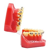 Vista 4 de Brcket dental del metal de ortodoncia con el modelo de los dientes de Typodont