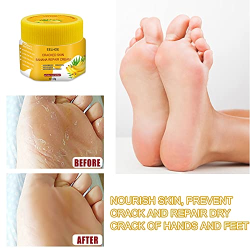 Singove 2Pcs Foot Peeling Foot Mask Cracked Skin Banana Repair Cream Peeling Cream,Antifreeze Cracking Cream, Repair Cream, Moisturize And Repair Dry And Chapped Feet And Hands, Yellow, 6.2*3.6*3.6Cm #TOP6