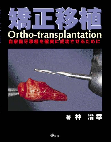 無料電子書籍 アプリ 矯正移植―自家歯牙移植を確実に成功させるために バイ