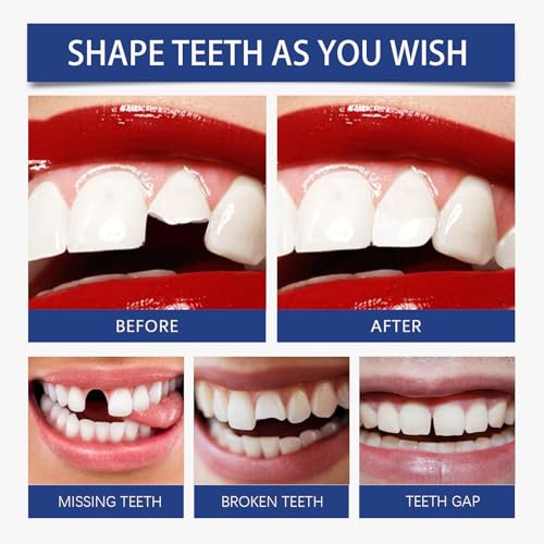Image of Dental Filling Beads(30ML /1FL.OZ) | Repair Broken, Missing Teeth, Large Gaps and Crooked Teeth | Comfort-focused experience, DIY Tooth Repair Kit