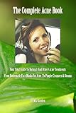 The Complete Acne Book: Your Total Guide To Natural (And Other) Acne Treatments From Homemade Face Masks For Acne To Pimple Cleansers & Steams