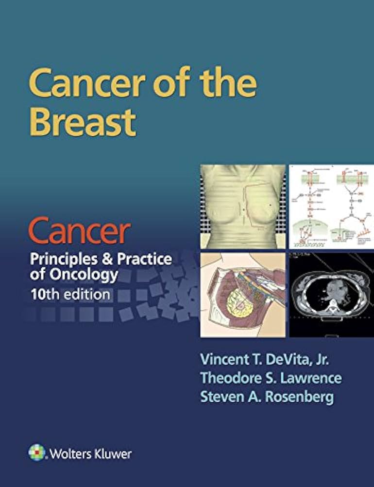 Amazon.co.jp: Cancer of the Breast: From Cancer: Principles