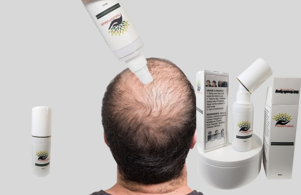 Amazon.com : Advanced Hair Growth Spray, Anti Baldness, Hair Loss