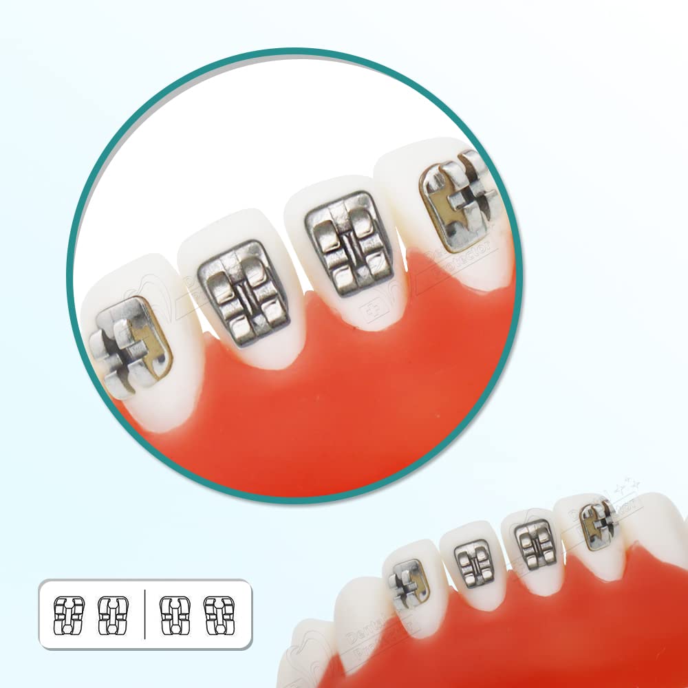 Kit De 10 Brackets Orthodontiques Mini MBT 0.022 345 Avec Crochets - Pour Traitement Dentaire - Matériel Neuf Sous Emballage