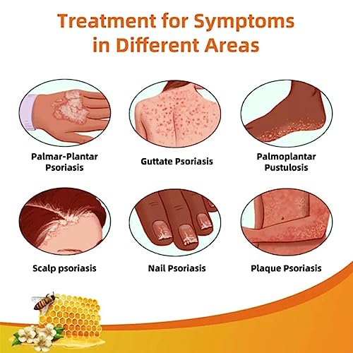 EXQST Crème apaisante hydratante apaisante pour Le Psoriasis au Venin d'abeille de Nouvelle-Zélande – vue 3