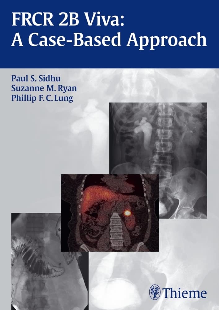 Buy Frcr 2B Viva: A Case-Based Approach: 1/E — BookShops.in