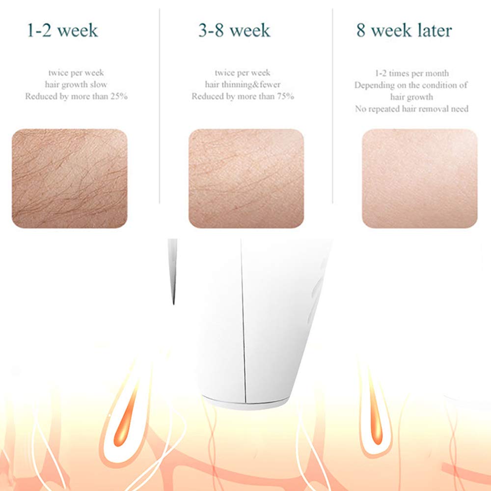 Sistema De Dispositivo De Depilación IPL Para Mujeres, Hombres, Depiladores 900,000 Flashes Sin Dolor Permanente Para La Cara Bikini Axilas Cuerpo Pierna