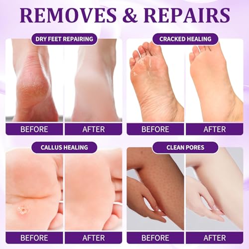 Foot Soak, Foot Spa Pedicure Set With Bath Salt, Foot Cream, Foot Scrub, Exfoliating Foot Care In a Box 4 Step Spa Pedicure Kit For Dry cracked Feet ,Lavender Foot Soak, 3 Set