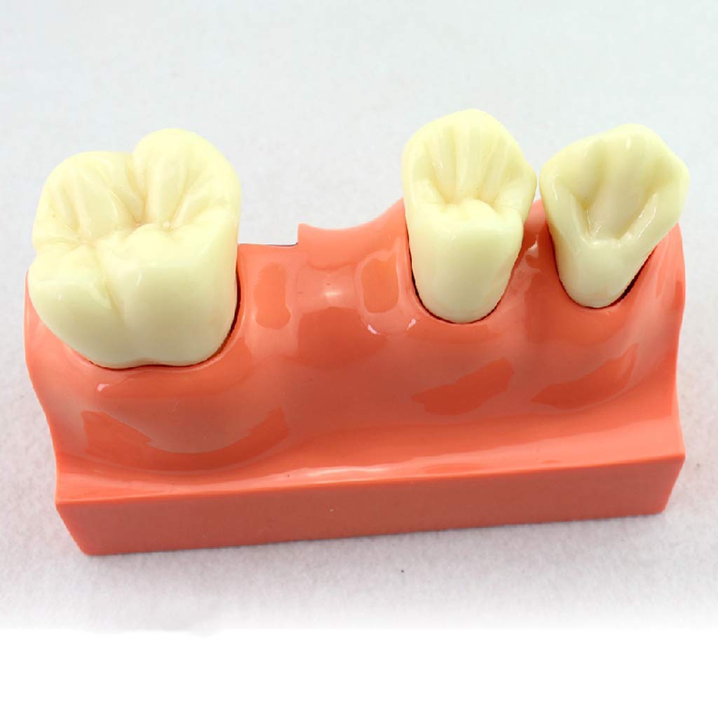 Modello di Anatomia per L'Insegnamento in Odontoiatria Modello Didattico per Lo Studio dei Denti Modello di Denti con Ingrandimento 4X Modello di Denti Dimostra