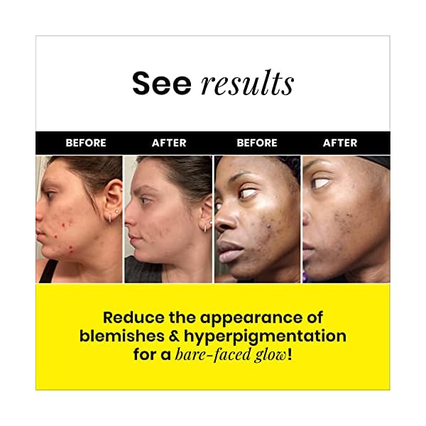 Gleamin-Turmeric-Vitamin-C-Clay-Mask-Mask-Brush-Clay-Face-Mask-with-Aloe-Vegan-Blemish-Treatment-Brush-Helps-Improve-Appearance-of-Dark-Spots-Scarring-No-Mix-Ready-to-Apply-21-Oz Gleamin Vitamin C Clay Mask for Dark Spots,10-Minutes Turmeric Clay Face Mask Skin Care, Deep Cleansing Pores - Facial Improves Uneven Tone, Post-Blemish, Visibly Brighten, Scarring & Texture - 2.5 Oz