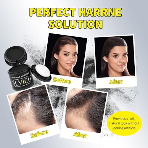 Sevich Hairline Powder 10g Large Capacity, Instantly Conceals Hair Loss, Root Touch Up - Image 4