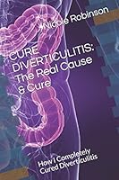 CURE DIVERTICULITIS: The Real Cause & Cure: How I Completely Cured Diverticulitis 1521930198 Book Cover
