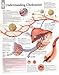 Understanding Cholesterol chart: Laminated Wall Chart