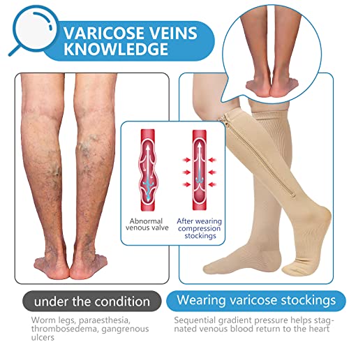 Image of bropite Zipper Compression Socks Women & Men|15-20mmHg closed Toe knee high | 2Pairs Calf Knee High 15-20mmHg closed Toe Compression Stocking suit for Walking Recovery, Pregnant, Nurse