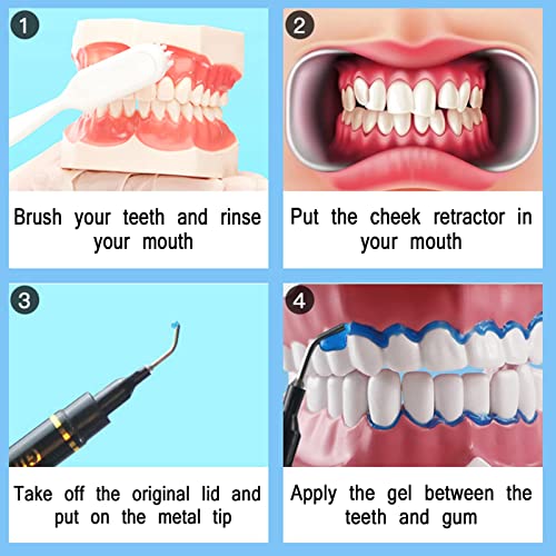 Dental Gingival Barrier Protection Gel, 10PCS 3ML Gum Protector Gel for Teeth Whitening - Imagem 5