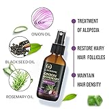 Lanthome Hair Growth Spray, Organic Onion Oil with Rosemary Scent, Enriched with Black Seed Oil, Controls Hair Loss, Promotes Growth, for Women and Men
