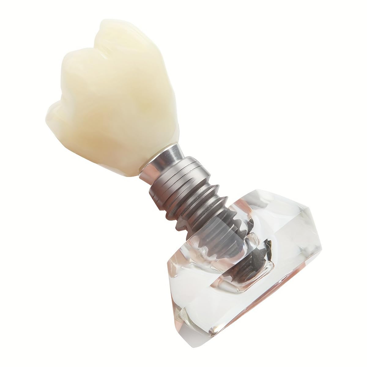 Dental Clear Implant Model Detail Implant Demonstration Detachable Crystal Crown Typodont Structure for Training and Education
