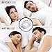 Sleepic Anti Snoring Clip, Silicone Magnetic Snore Stopper, Anti Snoring Device, Nose Clip for Men and Women(4PCS)