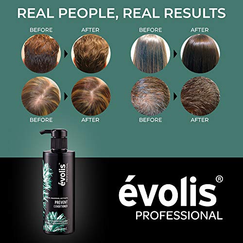 Évolis Prevent Conditioner - Anti Hair Loss Conditioner - Thickening Conditioner - Male Hair Loss Treatment - Hair Strengthening Conditioner (8.5 Fl Oz) #TOP3