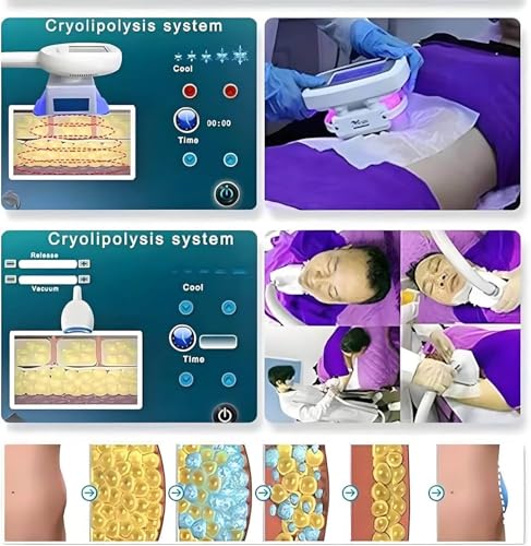 ZHPPED Appareil de cryolipolyse à 3 poignées pour l'élimination des Graisses par Le Froid, Appareil de remodelage corporel par cryolipolyse, Appareil de cryothérapie à 360°, cryoconservation – vue 7