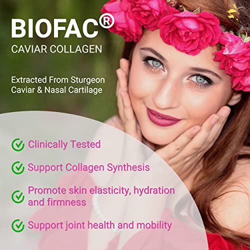 Image of UpNourish Probiotics, Caviar Collagen with Prebiotics for Women's Digestive, Skin Radiance, and Feminine Health with Cranberry Extract & D-Mannose, 30 Fast-melt Packets