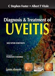 Diagnosis and Treatment of Uveitis - coolthings.us