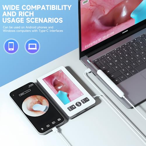 Ohrenreiniger Kamera, 4,3 ’’ 1080p HD Professionelle Ohrenschmalz Entferner Otoskop mit 6 LED-Endoskop, 3,5mm Ohr Kamera mit 64G Kinder- und Erwachsenenkarte, Plug -and -Play