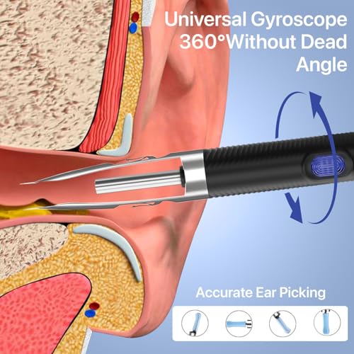 Image of DR VAKU CLENZIO PRO Earocam Earwax Removal Tool Kit with Forceps HD Camera Wifi Connection & 6 LED Lights Endoscope Tool Ear Cleaner for iOS & Android + 11 Silicone Tips Free- Black