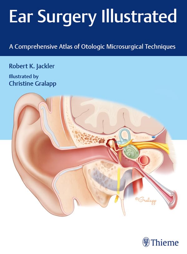Ear Surgery Illustrated: A Comprehensive Atlas of Otologic Microsurgical Techniques (English Edition)
