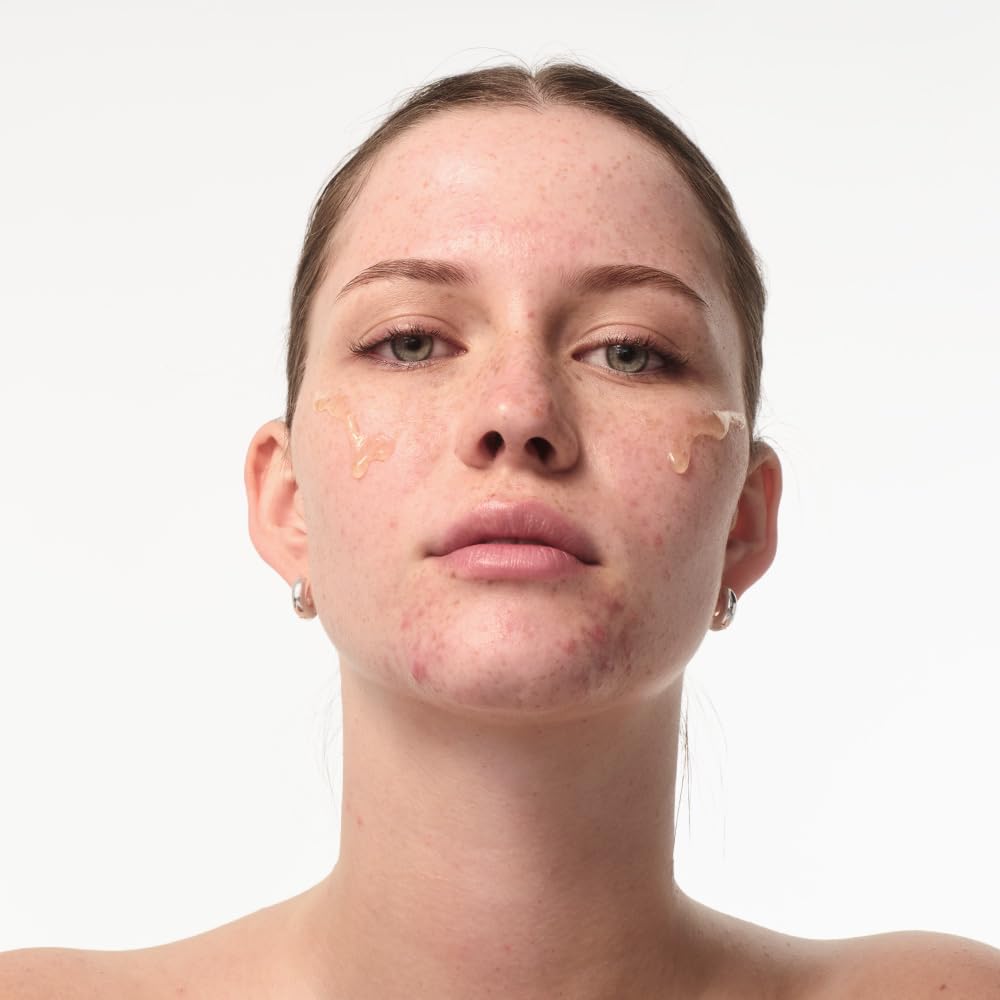 JUNGLÜCK Set Unreinheiten mindern SPF 30 | Reinigungsgel + Azelain Serum + Mattierende Tagescreme SPF 30 – klärt, beruhigt & schützt vor UV