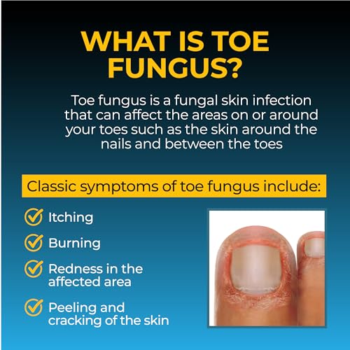 image for Fungi-Nail Pen Applicator Anti-Fungal Solution, Kills Fungus That Can 