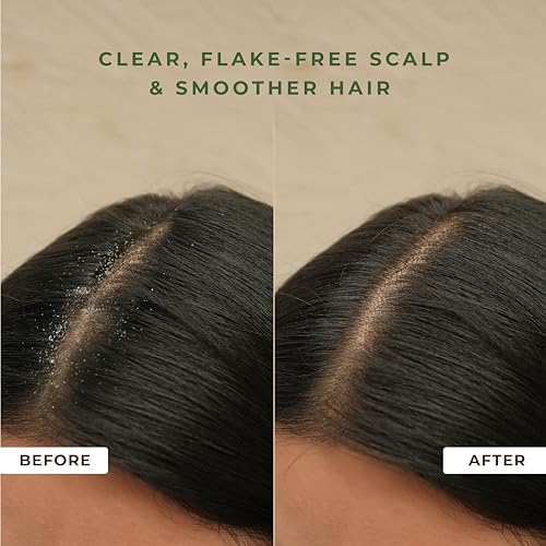 Image of Naturali Anti-Dandruff Conditioner with Sage & Salicylic Acid|No Sulphate, No Paraben|Calms Itchy Scalp|Exfoliates flaky scalp | Nourishes Strands | 180ml