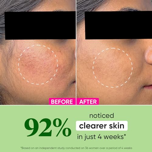 CICA + Niacinamide Oil-Free Face Moisturizer - Image 3