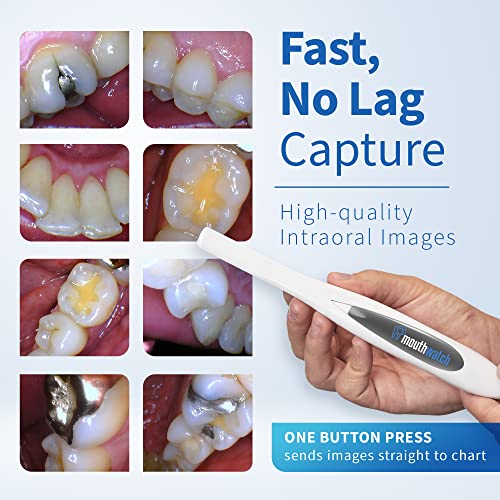 Intraoral Camera, Crystal Clear Images with an Easy to Use, Fast, Single Button Operation Dental Camera, Compatible with Over 50 Dental Imaging Suites, Lightweight and Ergonomic, 31 Grams