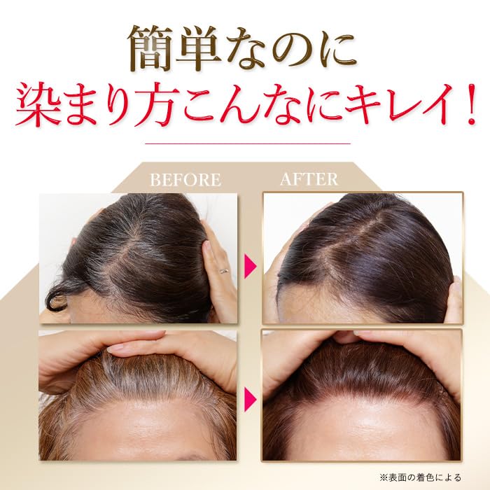 Amazon | ブラトリ（ダークブラウン） | Generic | 白髪染め 通販