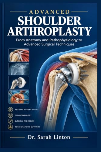 Advanced Shoulder Arthroplasty 838572799X Book Cover