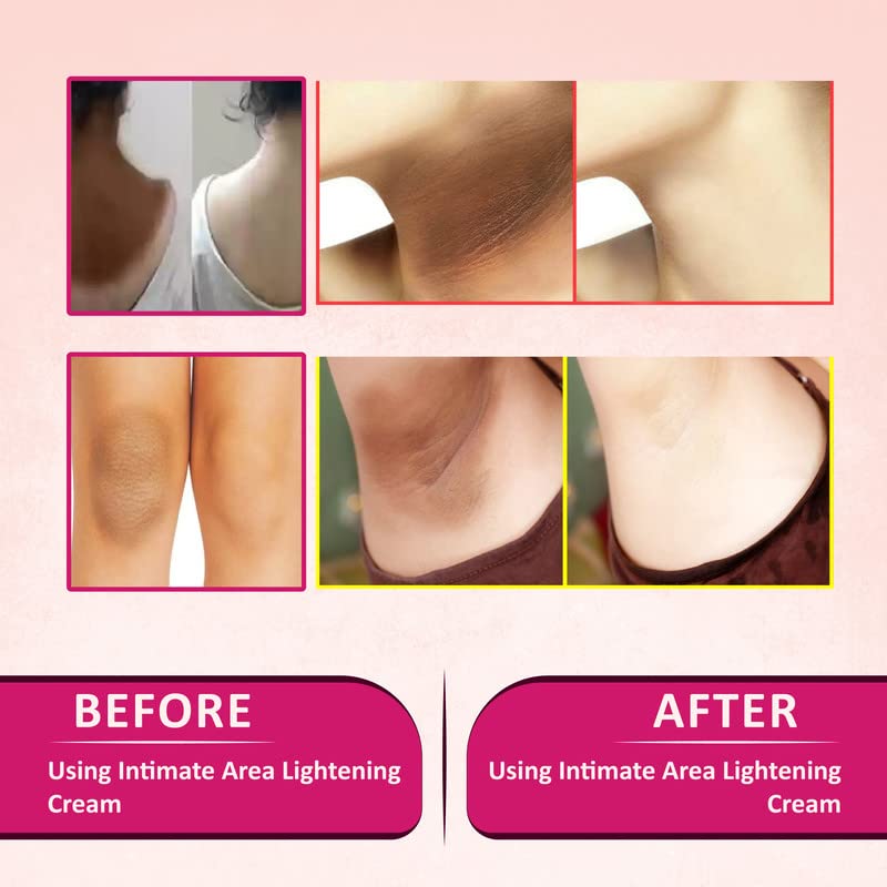 SABATES Intimate Area Lightening and Whitening Cream For Underarm, Bikini Area, Neck, Hip, Thigh, Intimate Area, Elbow Intense Dark Spot Removal | Intimate Area Whitening Cream (Herbal Cream) 1