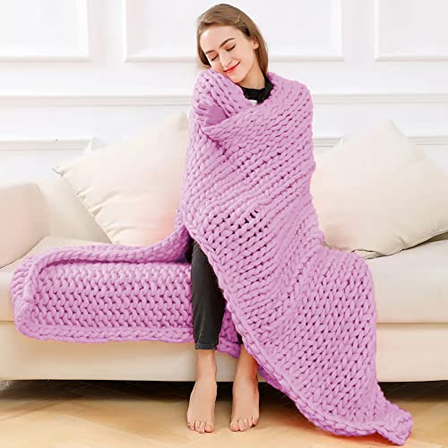 Chunky Yarn For Arm Knitting, Giant Soft Fleece Yarn Bulky Yarn For Throw Blanket Pillow For Weave Craft Crochet, Diy Sofa Bed Blanket Pillow Pet Bed And Bed Fence (Purple-(2.2Lbs)) #TOP4