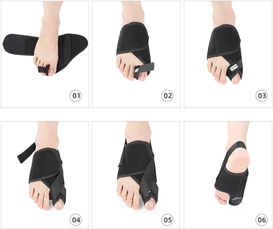 DEAVER Bunion Corrector,Bunion Pain Relief Toe Separators,Adjustable Size Hallux Correction Bunion Splint Corrector for Men and Women,Day Night Support