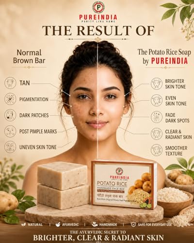 Image of Potato Rice Soap for Natural Skin Whitening and Pigmentation, Minimizes Open Pores, Removes Impurities | The Natural Way of Skin Whitening 100-gm Pack of -1