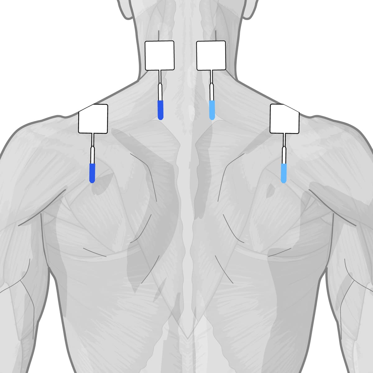 GLOBUS | Genesy 300 PRO, Elettrostimolatore a 4 Canali, 91 Programmi per La Fisioterapia